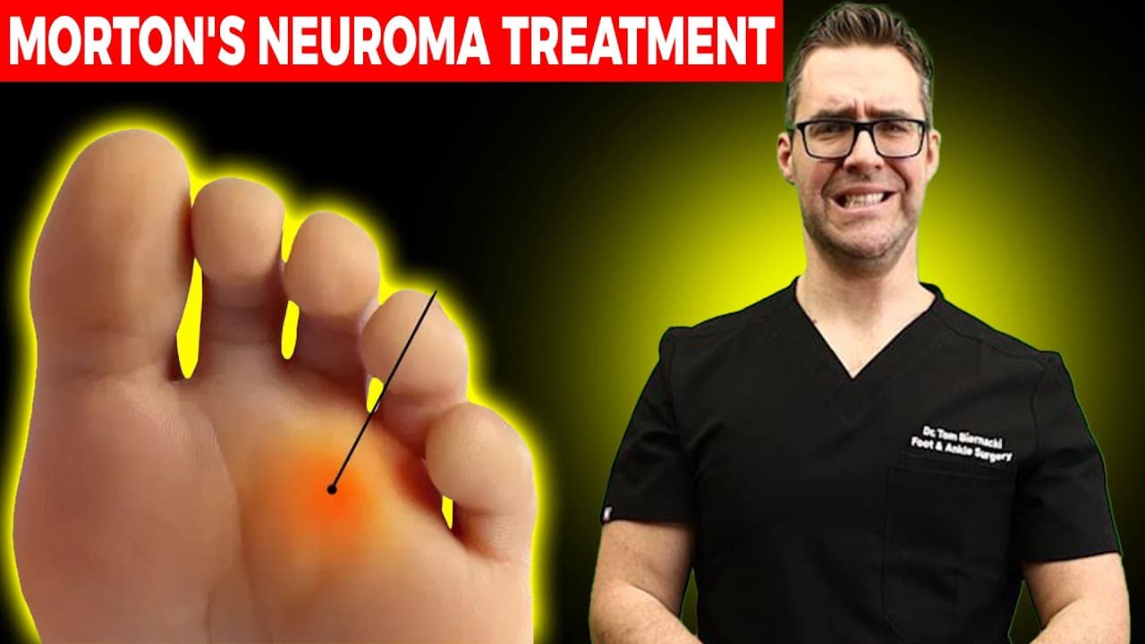 mortons neuroma treatment