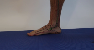 pt tendon flat foot