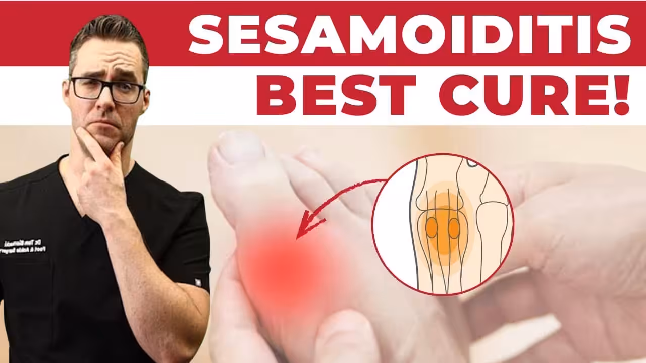 sesamoiditis treatment