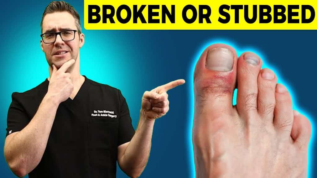 fractured hallux