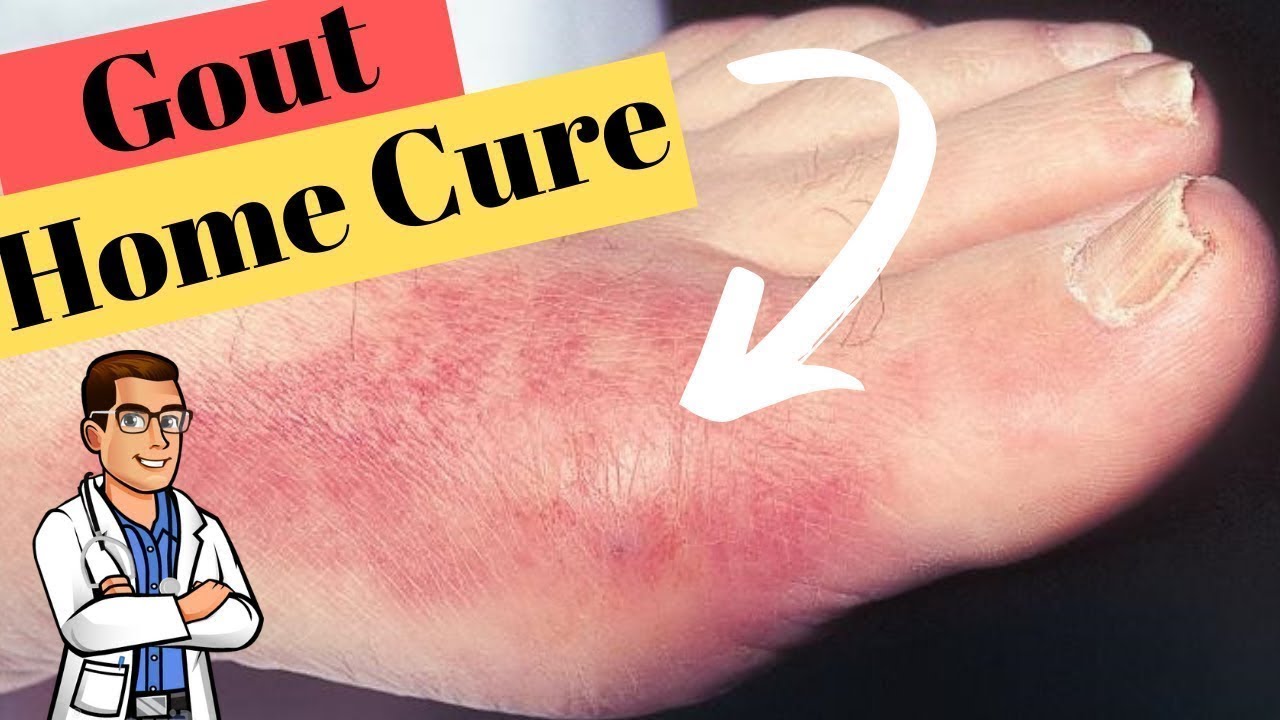 gout