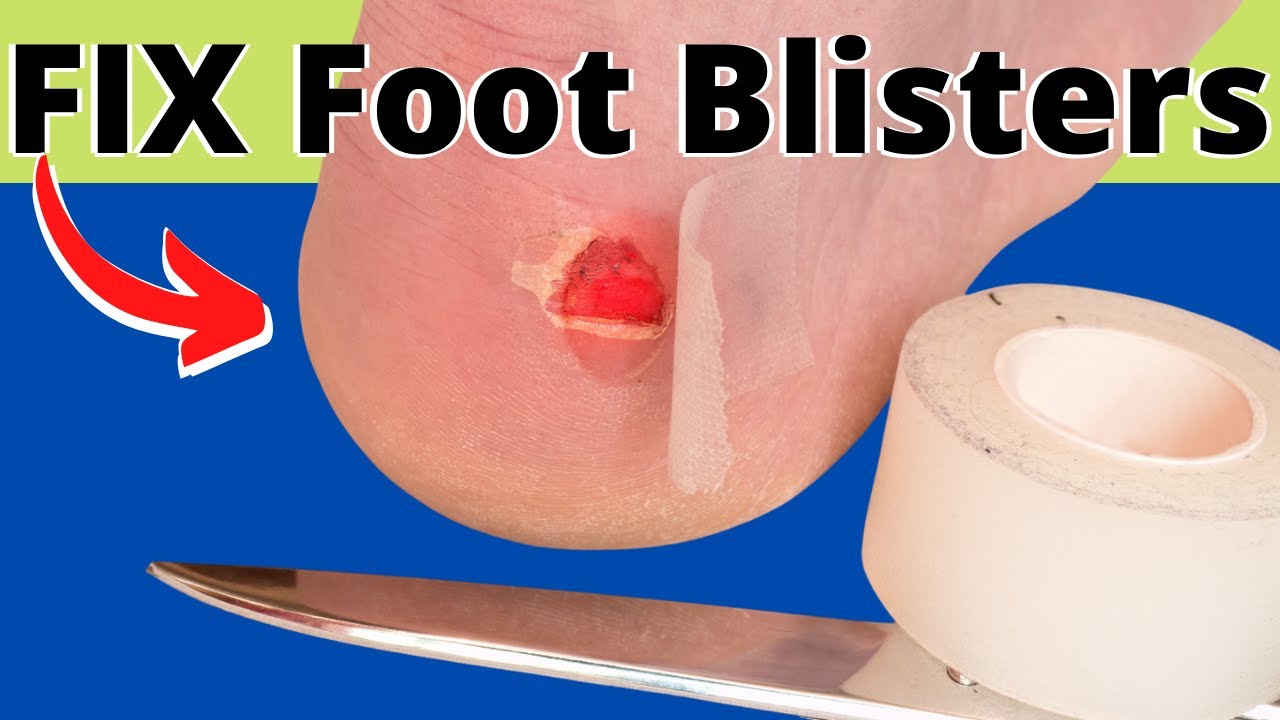 How to fix sore toe blisters and sore foot blisters.