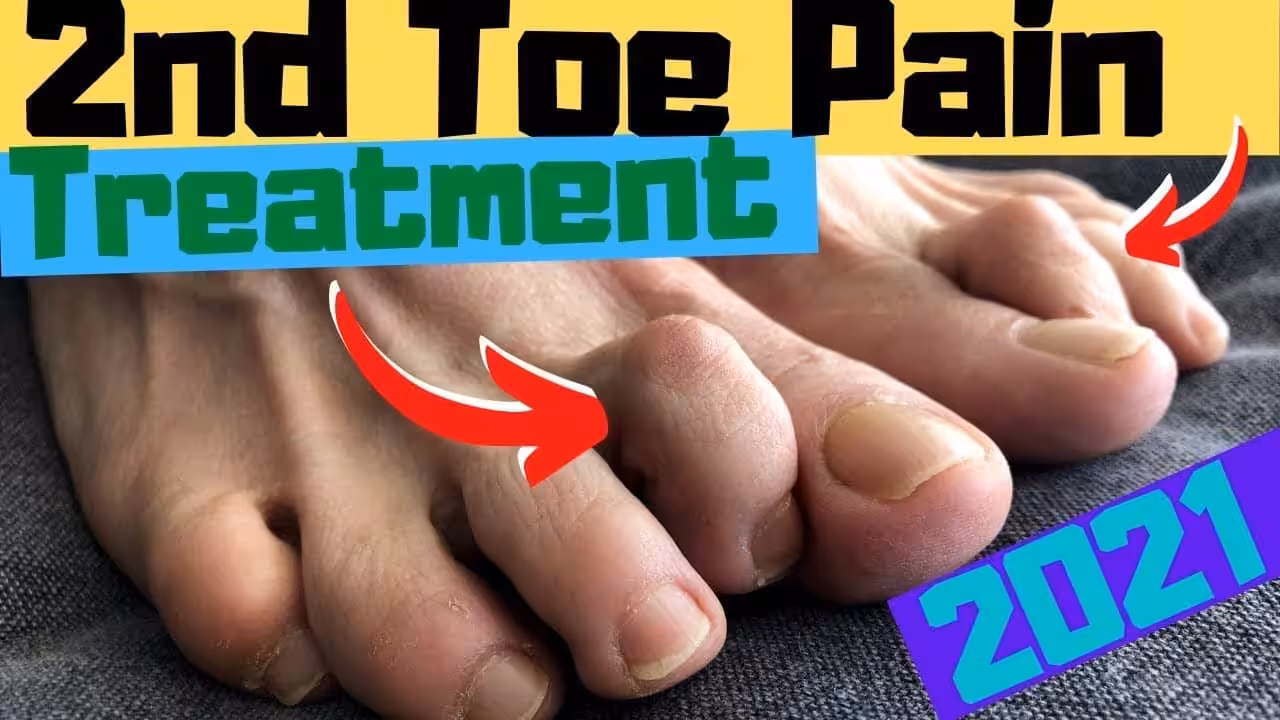 Pain in the Ball of the Foot in Second Toe