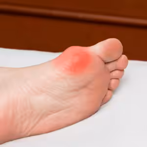 Common Foot and Toe Ailments