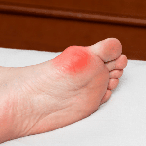 Common Foot and Toe Ailments