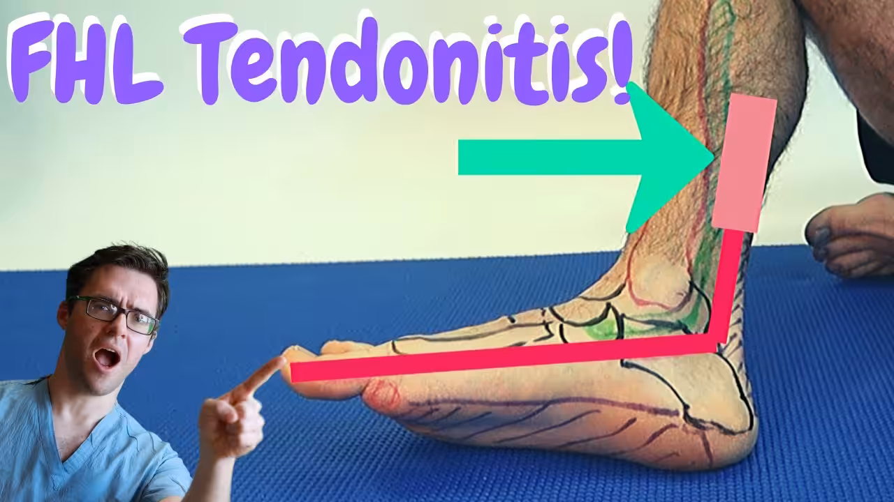 Flexor Hallucis Longus Tendinitis