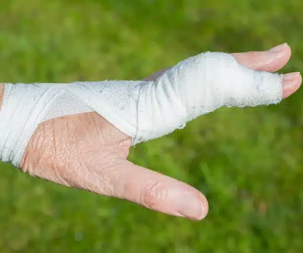 ganglion cyst on foot