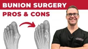 Great Toe Joint Fusion Surgery