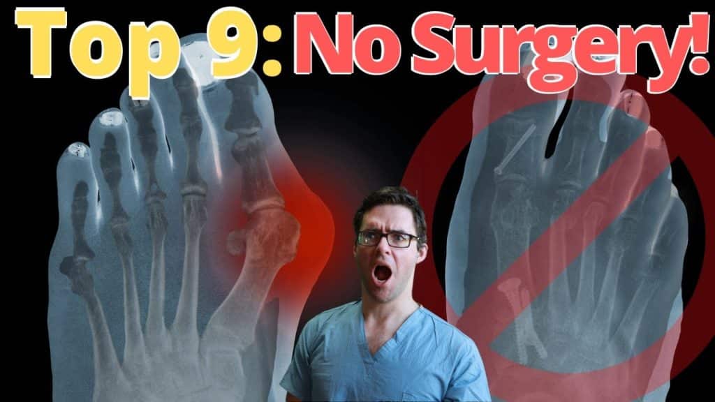 great toe joint fusion Archives