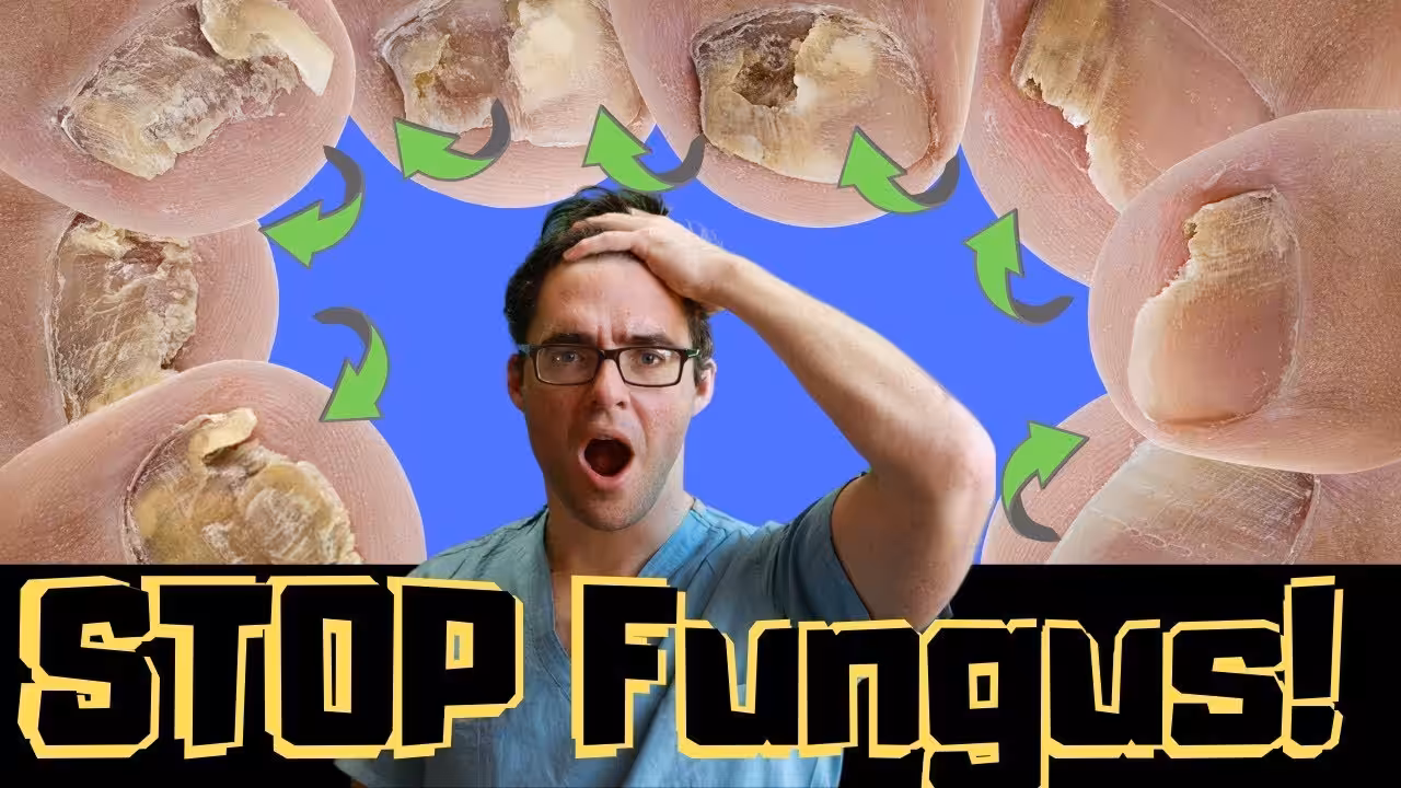 How to Fix Severe Toenail Fungus