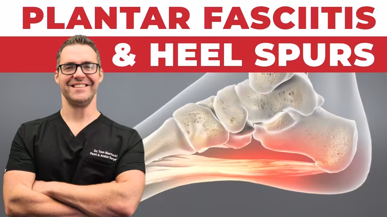 Inflamed heel pad and Achilles tendon anatomy diagram — heel pain treatment at Balance Foot  Ankle Michigan