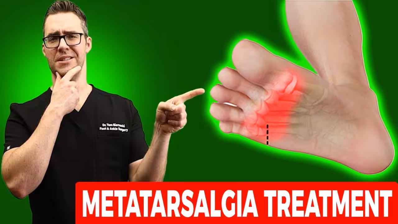 Pain in Sole of Foot Near Toes