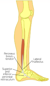 Peroneus Brevis Anatomy Peroneus Brevis Tendonitis