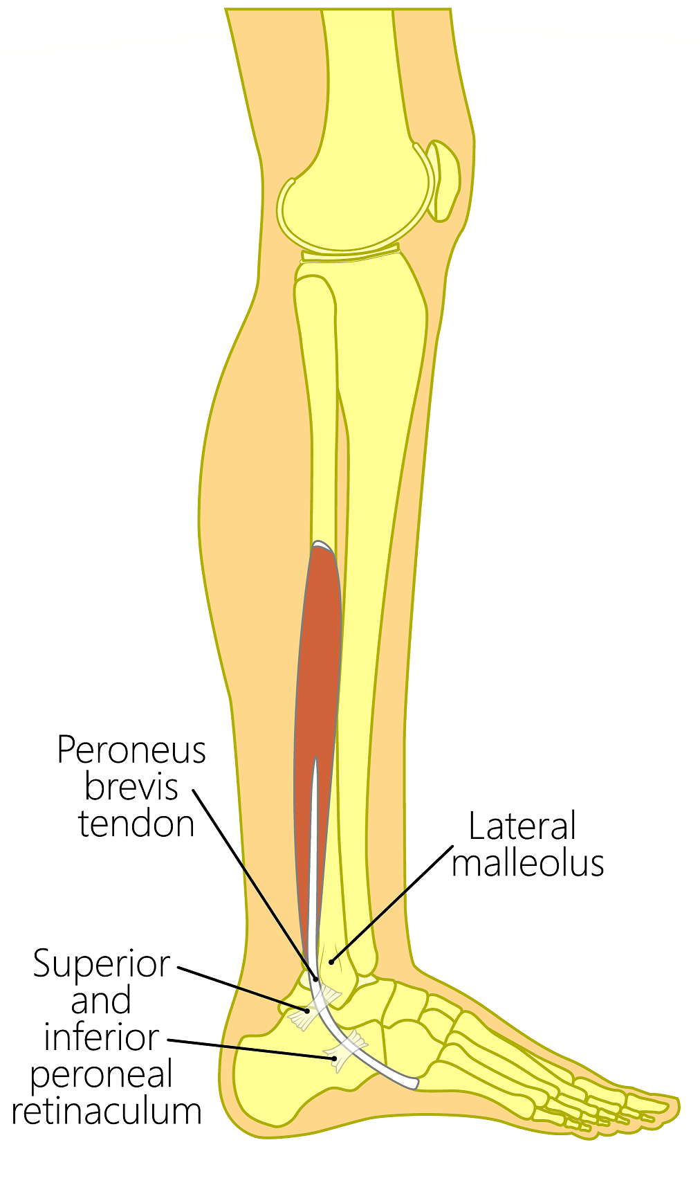 Ankle Tendonitis Treatment *Causes, Symptoms & Treatment*