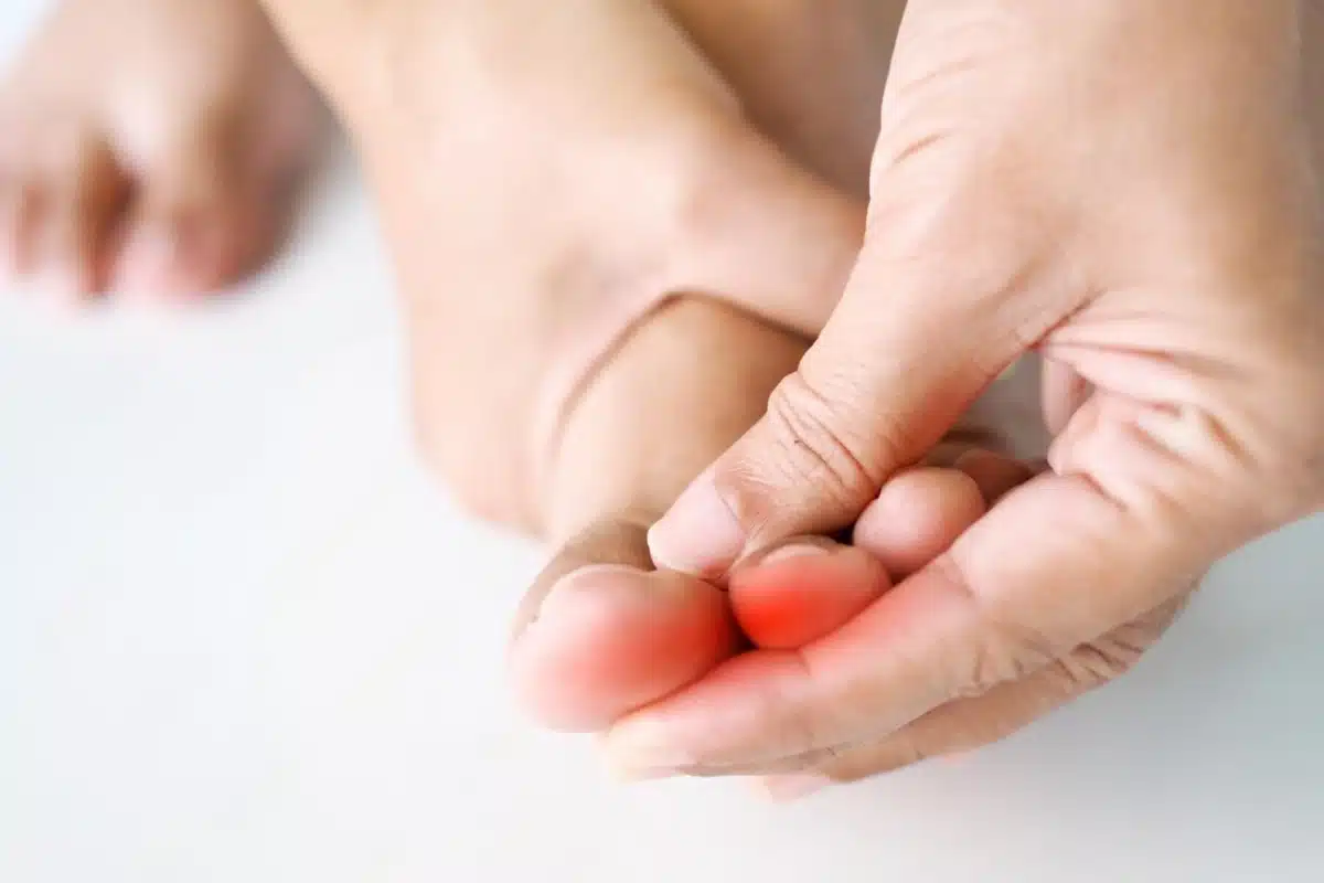 Second Toe Pain Due To A Hammer Toe 2 - Balance Foot & Ankle