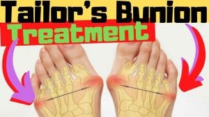pain under pinky toe