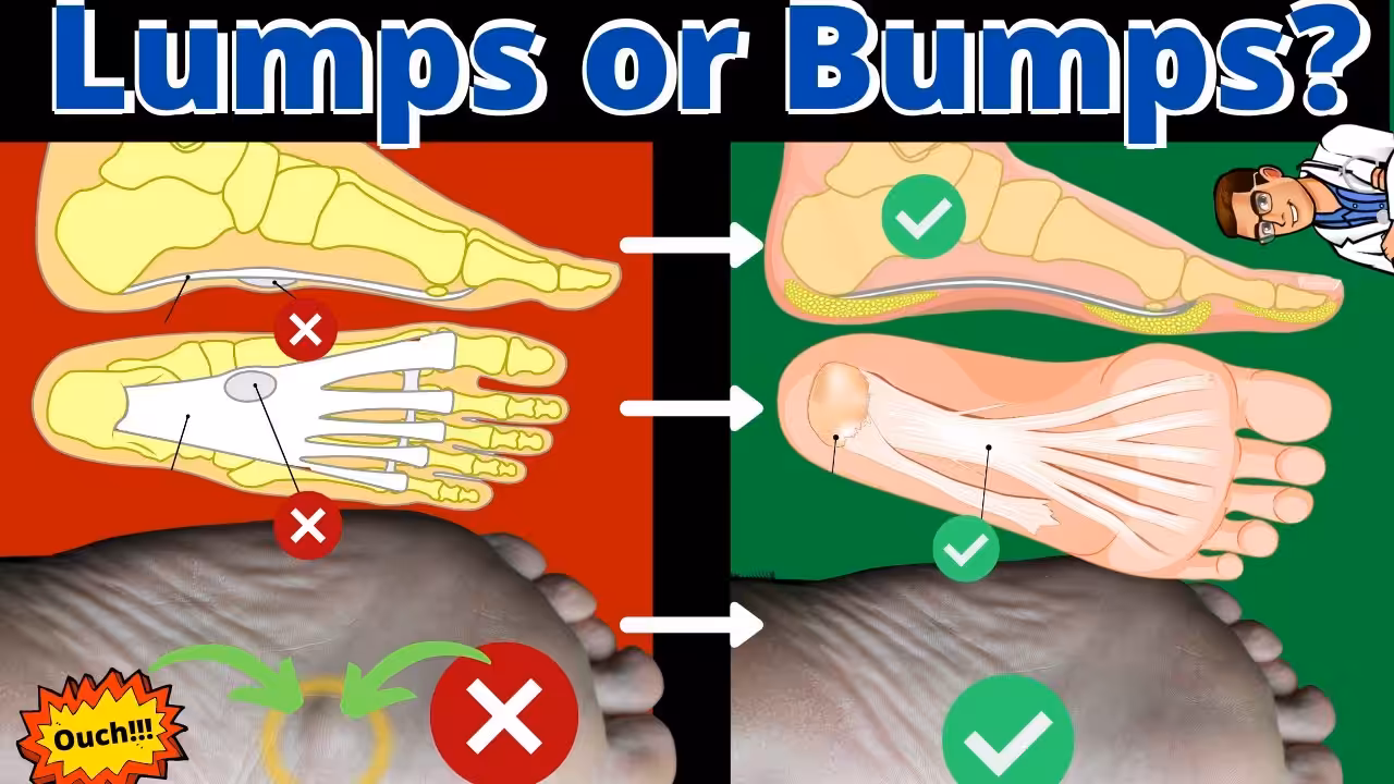 Soft Lump On Foot Or Ankle 2 - Balance Foot & Ankle