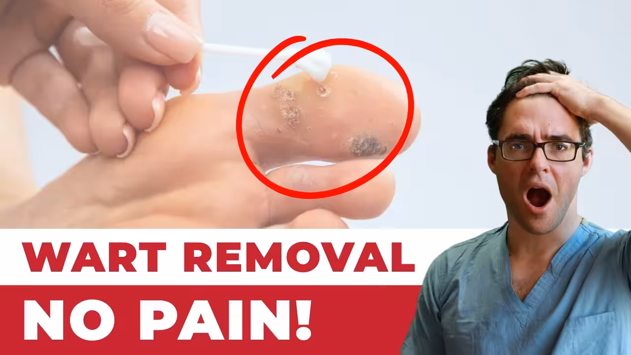 The Best Verruca Home Remedy | Balance Foot & Ankle