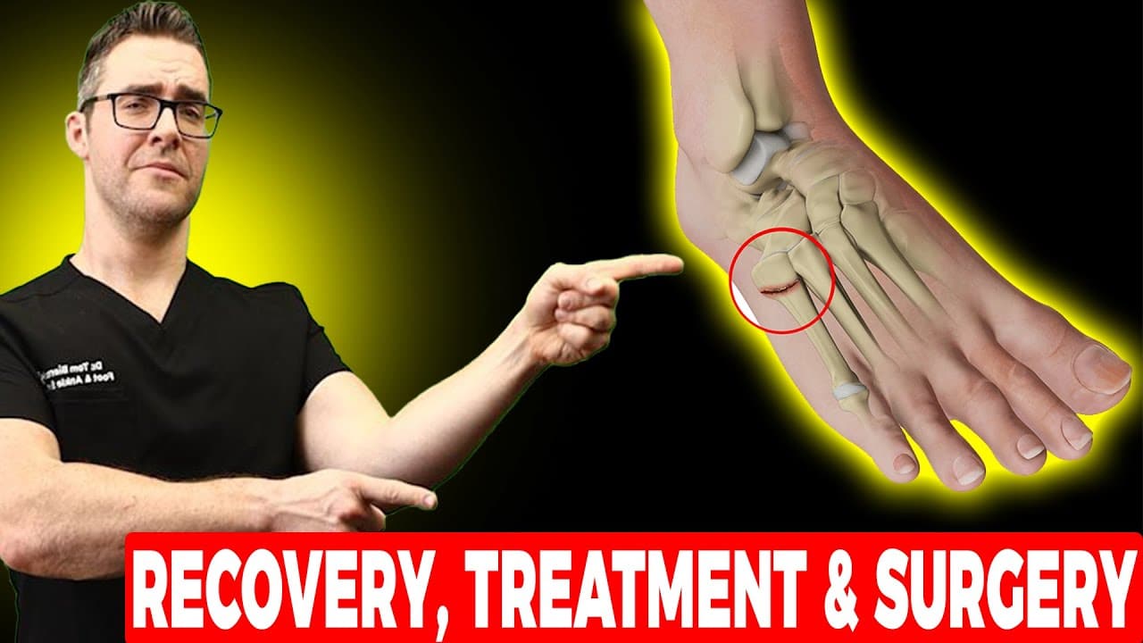 Essential Steps for Jones Fracture Treatment Recovery