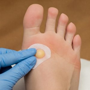 Foot Corn Cure 1 foot corn cure