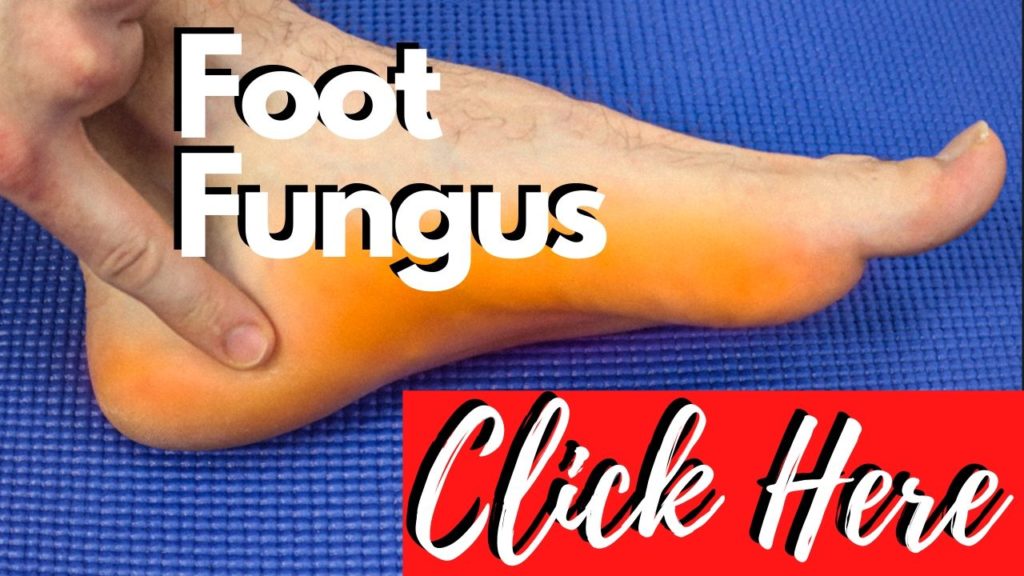 Best Foot Fungus Home Treatment