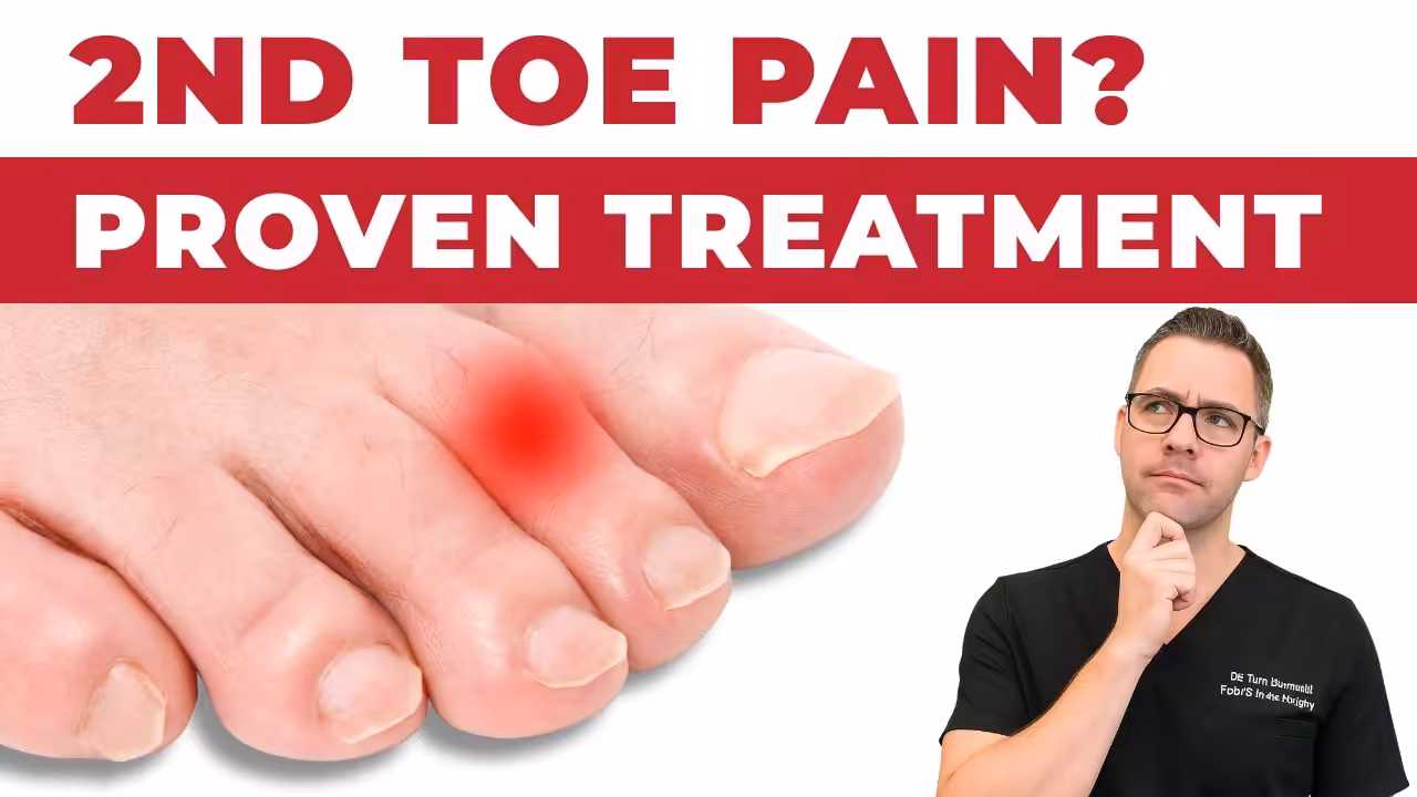 Second Metatarsal Overload Syndrome Treatment 2 - Balance Foot & Ankle