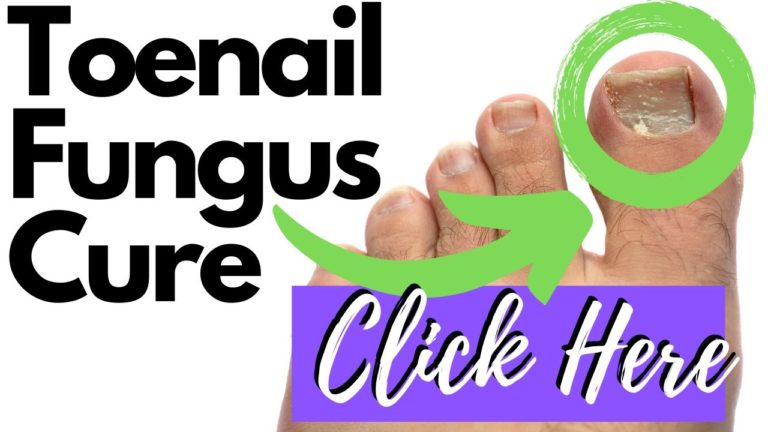 Toenail Fungus Best Treatment Products