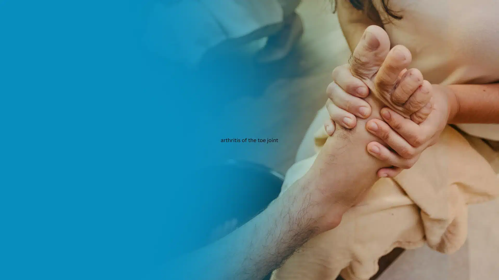 Arthritis In Big Toes Treatment 1 - Balance Foot & Ankle