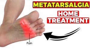 Arthritis In The Ball Of My Foot