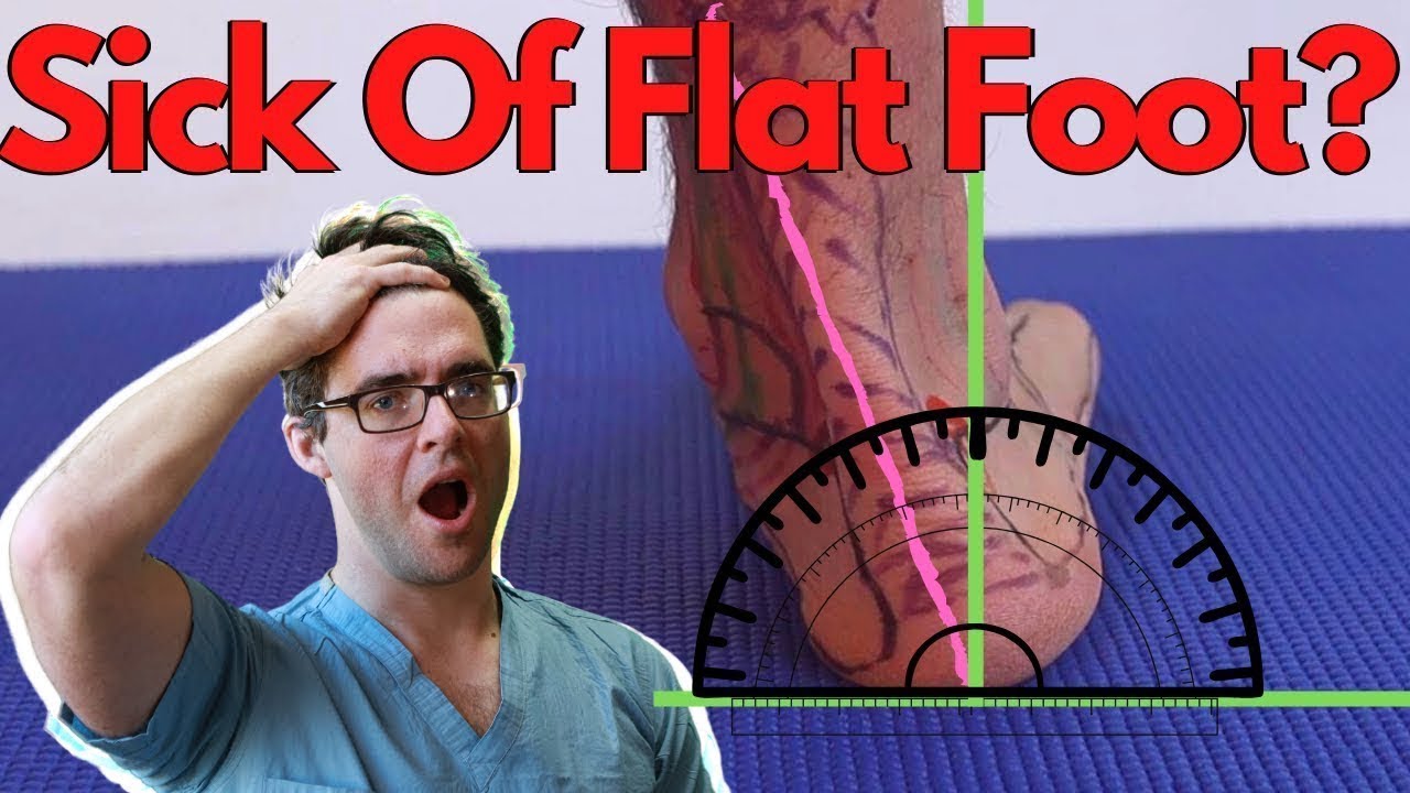 foot arthritis 2