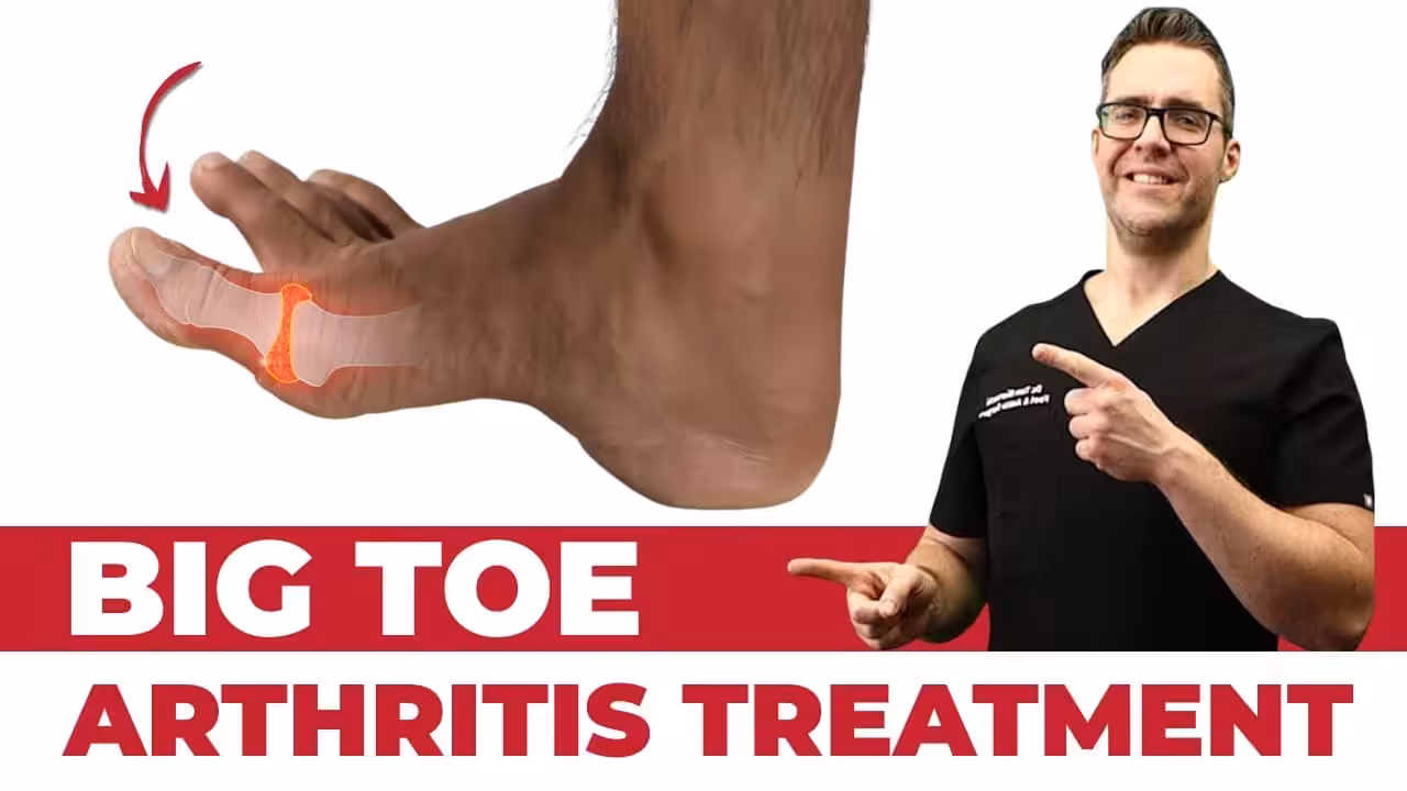 Toe Arthritis | Balance Foot & Ankle