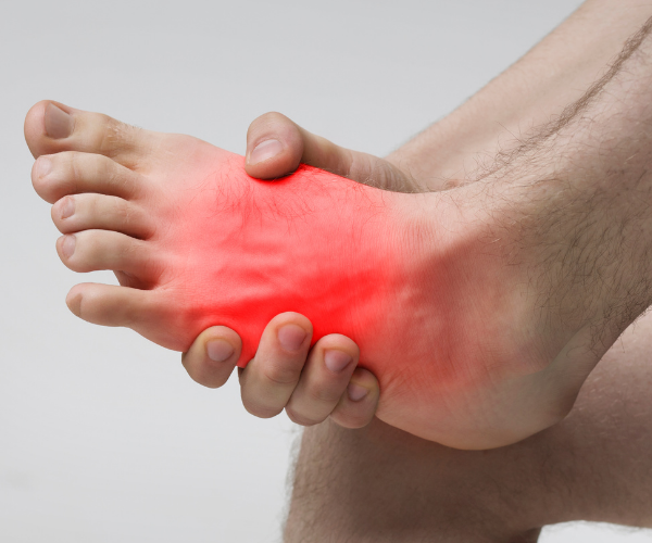 dorsal foot pain 2