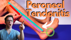 Peroneal Tendonitis Treatment Sore feet sore ankles