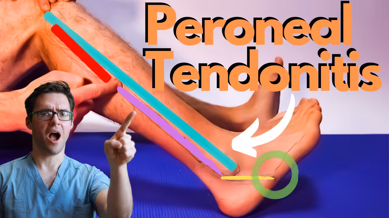 Peroneal Tendonitis 3 - Balance Foot & Ankle