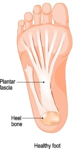 EPAT Shockwave therapy for plantar fasciitis