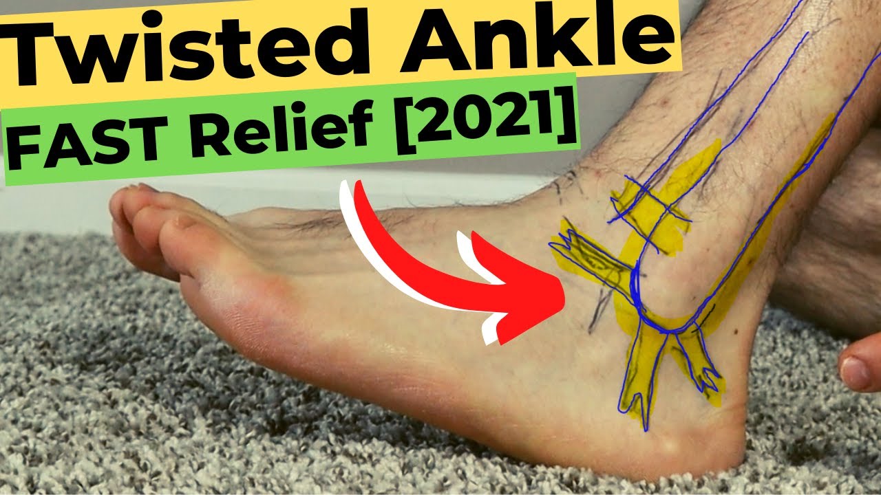 signs of broken ankle vs sprained ankle