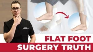 Is Flat Foot Surgery Worth It