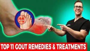 Gout On Top of Foot
