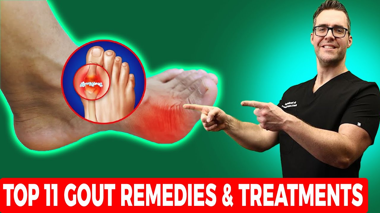 Gout On Top of Foot