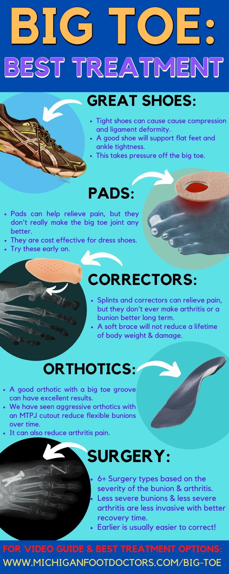 Bunion, hallux rigidus treatment