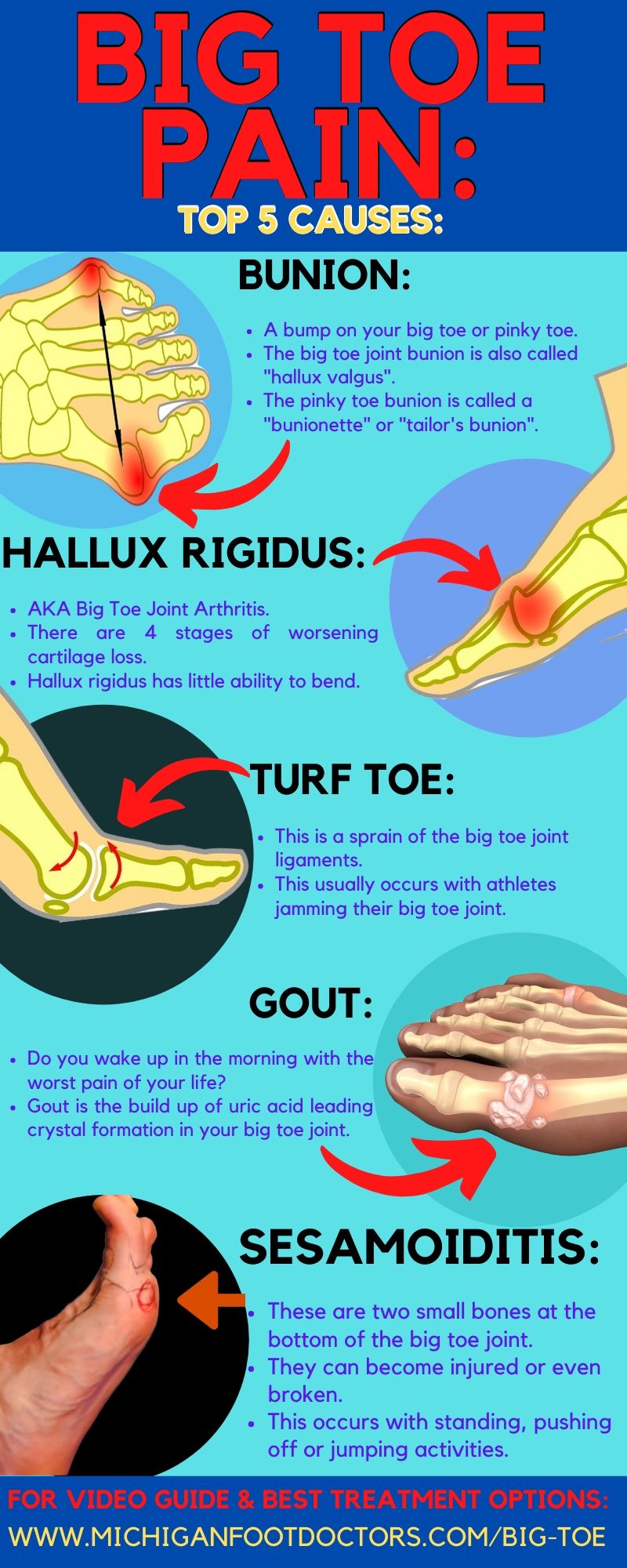 Throbbing Big Toe Pain At Night [Causes, Symptoms & Best Treatment]