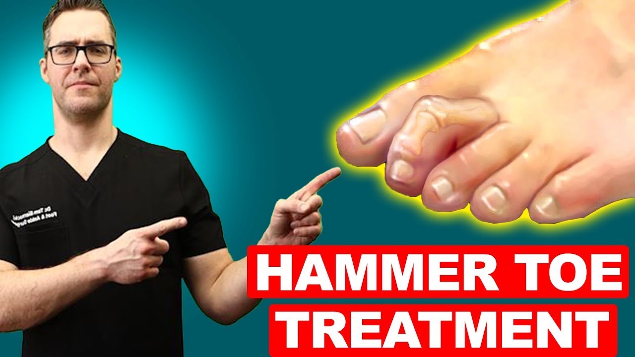 middle toe pain