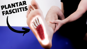 Foot Arch Pain: Causes, Symptoms & Best Treatment 2020