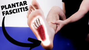 calcaneus foot pain plantar fasciitis