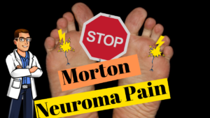 Morton Neuroma & Morton Neuralgia Pain