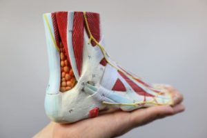 Pain Above the Heel in the Back of the Foot