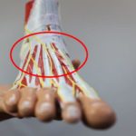 Radiating nerve pain on top of the foot
