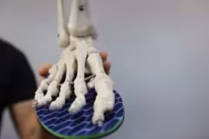 Twisted Ankle Sprain Recovery Time 