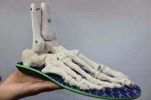 Little Toe Pain Causes 4 Outside of the foot pain and little toe pain