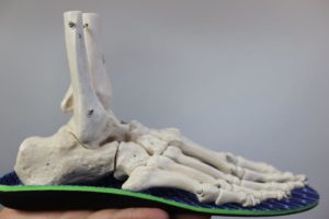 Pain On Outside Of Ankle 2 Ruptured Ankle Ligament Tear stage 3 ankle sprain